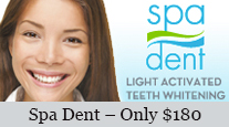 Spa Dent Teeth Whitening